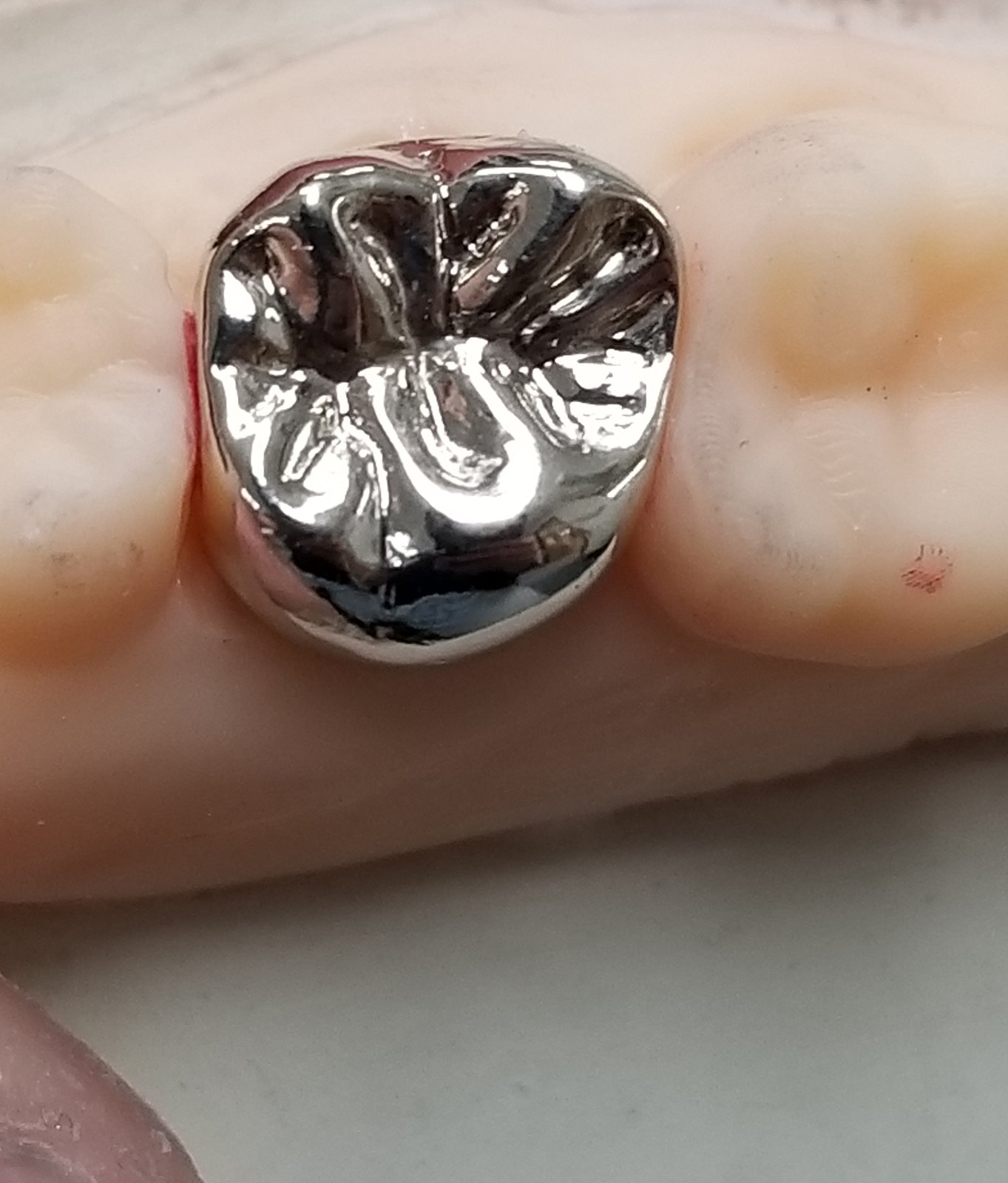 Full gold posterior crown showing occlusal anatomy