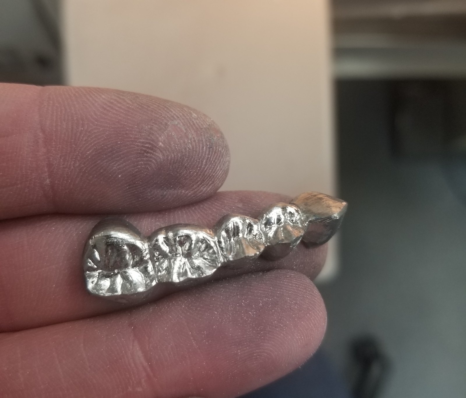 As-cast metal bridge held at the bench