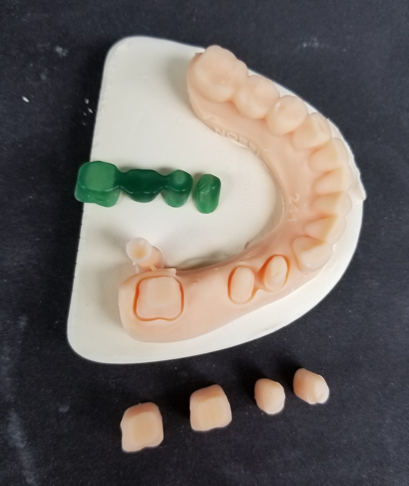 Printed dies and wax patterns on a working model